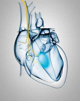 Wirkungsprinzip der CCM-Therapie CCM ist eine etablierte Methode zur Ver stär kung der Kontraktilität des Herzens und zur Ver besserung der biochemischen Prozesse in den Herz muskelzellen
