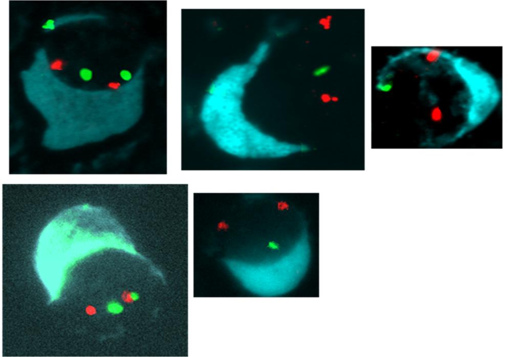 FISH Darstellung von Chromosomenregionen Normal: 2 homologe Chromosomen 2 Spots