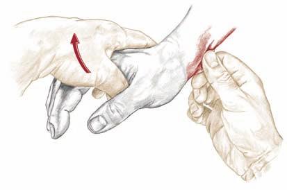 Das Gewebe am Unterarmschaft ist dabei möglicherweise schwieriger zu greifen als das Gewebe im Handgelenks- und Ellenbogenbereich. 1.