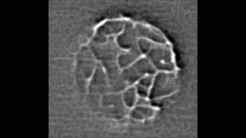 Anwendung 3: Apotom und TIRF Beispiel für den Einsatz von TIRF TIRF-Aufnahmen von GFP-markiertem Actin auf der Oberfläche eines Fibroblasten zeigt