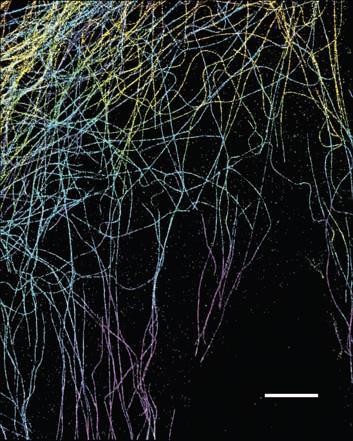 Perspektiven: Jenseits der Auflösungsgrenze Beispiel für PALM/STORM Mikrotubuli in Säugerzelle.