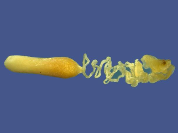 14: Stangeria eriopus, Makrosporophyll; junge Samenanlagen von Blattgewebe fast vollständig umschlossen; Abb. 15: Zamia amblyphyllidia, Querschnitt durch einen reifen Samen; Abb.