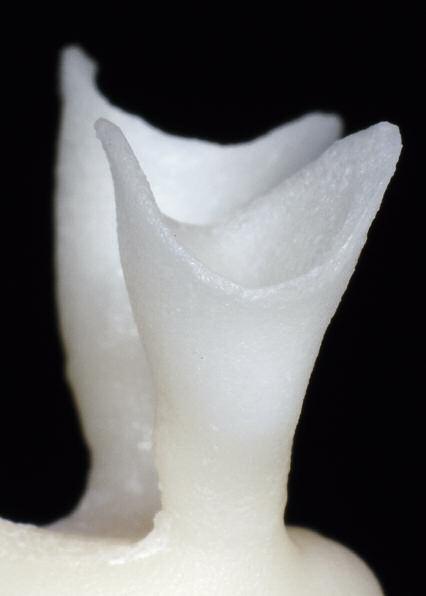 Lithium Disilikat Lithium Disilikat Keramiken finden im Dentallabor eine immer breitere Anwendung zur Herstellung von Zahnersatz.