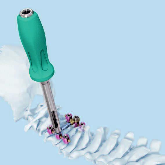 Entfernen von Implantaten Querverbinder für Kopf-zu-Kopf-Verbindungen entfernen Instrumente 03.614.040 Sechskantschraubendreher 7.5 mm locked 388.