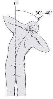 2.5.1 Seitwärtsneigung Die Seitwärtsneigung wurde nach links und nach rechts erhoben, wobei der Patient aufrecht stehen sollte und die Hände in den Nacken legen musste.