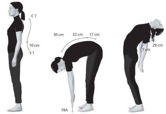 Abbildung 16 zeigt als Funktionstests der Wirbelsäulenbeweglichkeit zusammengefasst das Schober-, das Ott-Zeichen und den Finger-Boden-Abstand (FBA)