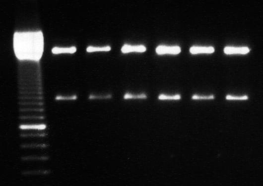 1200 bp 800 bp 1 2 3 Abbildung 4.6.1.3 Verdau pbluescript-plasmid nach Excision aus 3 rekombinanten Klonen (1-3). Größe CD30-Antigen: 1147 bp.