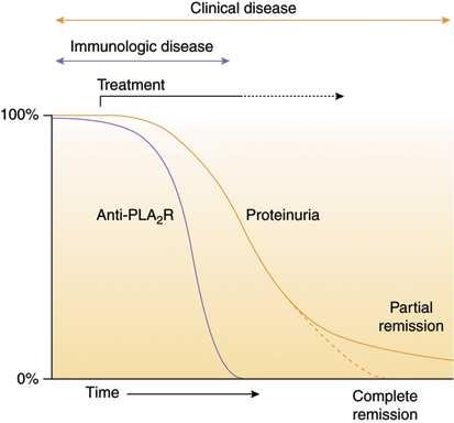 Anti-PLA2R Korrelation mit der