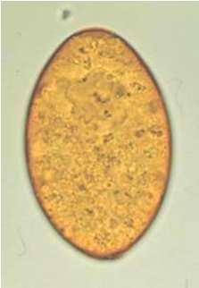 Großer Leberegel (Fasciola hepatica) Plattwurm Lebt in der Leber in den Gallengängen Eier werden mit der Galle in den Kot