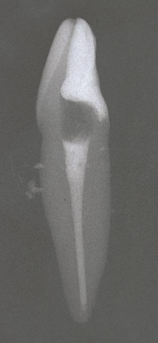 - 55 - Abb. 9: Röntgenbild eines unteren Inzisivus der Gruppe 2, aufgenommen in der mesial/distal-exzentrischen Projektionsrichtung.