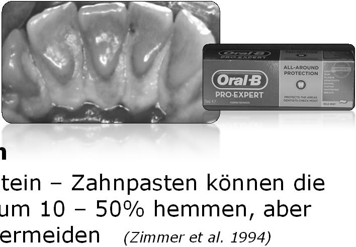 blend a med PRO EXpert Zahnstein Antizahnstein