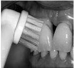 Quadrantenweise Elektrische Zahnbürsten Instruktion