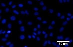 HeLa Zellen wurden mit JMJD2A mit FLAG Tag transfiziert, nach 24 Stunden Inkubation mit den Hemmstoffen in den