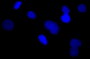 4.3. Untersuchung des Effekts auf die Histonmethylierung DAPI Anti H3K9me3 DMSO IOX1 30 µm JIB 04 0,3 µm GSK J4 3 µm Abb. 4 43: IOX1, JIB 04 und GSK J4 erhöhen H3K4me3 in KYSE 150 Zellen.