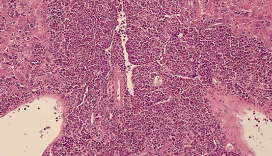 Ergebnisse roten Pulpa war das gesamte Spektrum der myeloiden Reifungsreihe zu finden, wobei unreife Zellelemente, bei Maus #163 mit einem Blastenanteil von über 20%, überwogen und ebenfalls vermehrt
