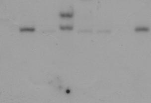 31: Southernblot-Analyse der an der myeloiden Neoplasie erkrankten Mäuse sowie einer Retransplantation dieser Erkrankung Die isolierte und aufgereinigte Milz-DNA wurde mit den Restriktionsenzymen