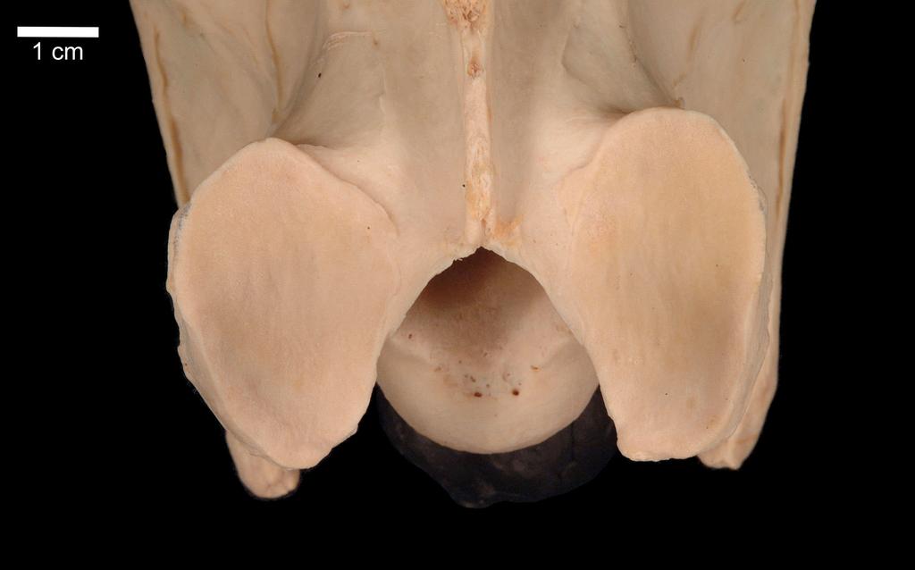 62: Kraniale Gelenkfacetten des dritten Halswirbels des Pferdes V9 in der Ansicht von dorsal (vgl.