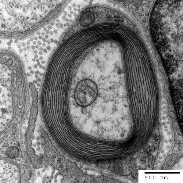 Myelinisiertes Axon Hypothese: Ablagerung langkettiger Fettsäuren in Membranen