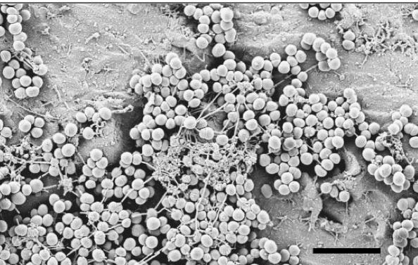 Biofilm Einschluss der Mikroorganismen in eine Polymer- Matrix Struktur ähnelt einem vielzelligen Organismus Bietet Schutz vor körpereigener