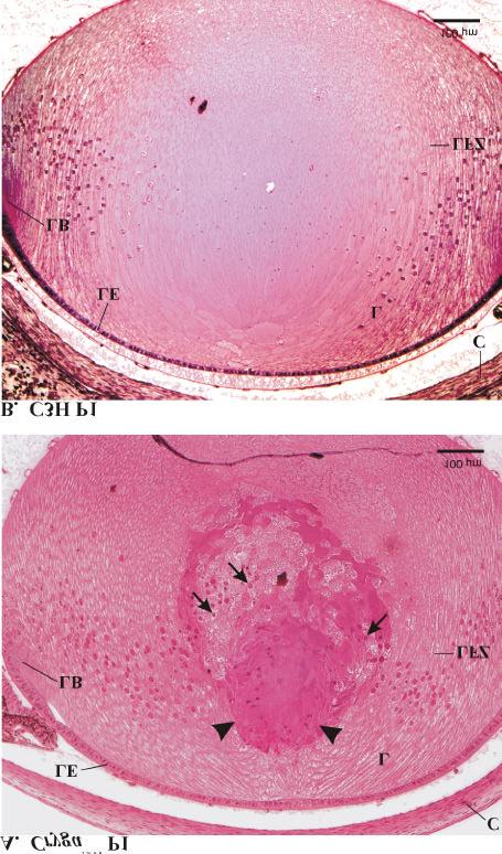 4 Ergebnisse 48 Abbildung 4.3 A Augenlinse einer neugeborenen Cryga 1Neu Mutante (P1) im histologischen Schnitt (Methylenblau/Fuchsin Färbung). B Im Vergleich ist eine C3H Wildtyp-Augenlinse gezeigt.