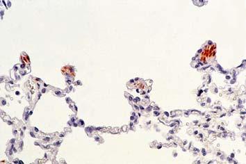 Intrapulmonale Muskulatur: - in den Atrien der Alveolaren befindet sich ein Ring von glatter Muskulatur - Regulation des Luftzutritts zu den Alveolen - auch wirksam bei forcierter Exspiration (die