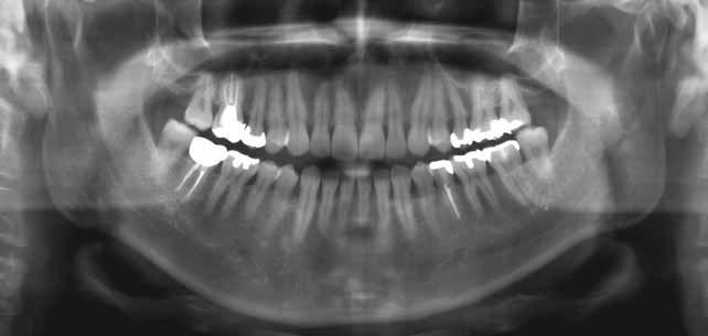 Aufnahmen hoher Qualität Direkte Digitale Belichtungsautomatik (DDAE) DDAE steuert die Röhrenstromstärke (ma) während der gesamten Aufnahme anhand der am Sensor detektierten, durch den Patienten