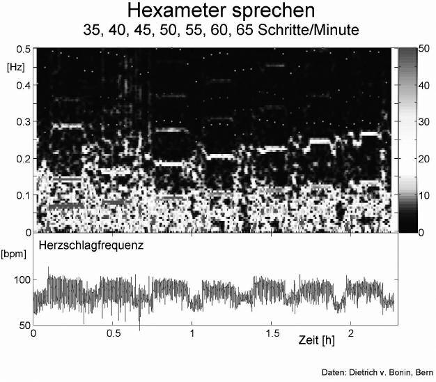 Bild 10: Bild der Herzrhythmen während des Sprechens von Hexameter mit verschiedener Sprechgeschwindigkeit.
