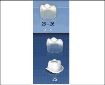 15 Abutments Sirona Dental Systems GmbH 15.1 Abutment - Biogenerik Individuell - MultiLayer 15.1.10 Parameter anpassen Anleitung Der Schritt "Restaurationsparameter" ist aktiv. 1. Passen Sie gegebenenfalls die Parameter an.