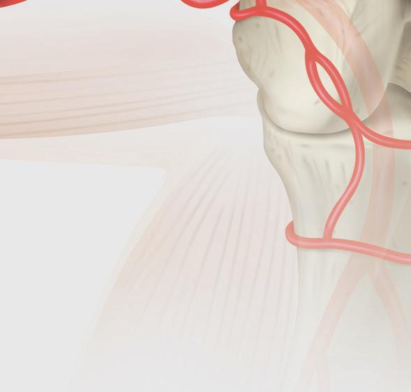 stenting, including vascular complications and/or