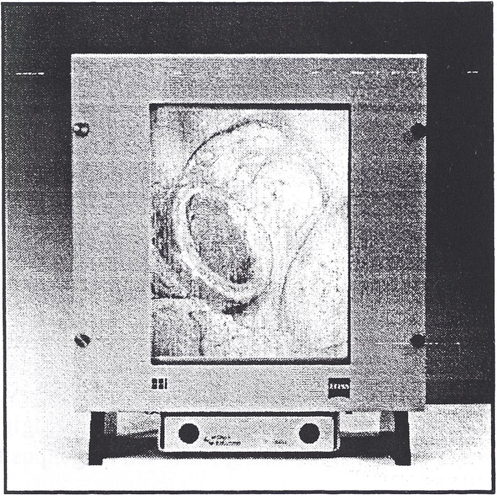 Weiterhin ist ein flacher Monitor von Firma Carl Zeiss in Oberkochen gebaut worden, der aus einem LCBildschirm besteht, und auf dessen Frontseite eine in lateraler und frontaler Richtung bewegliche