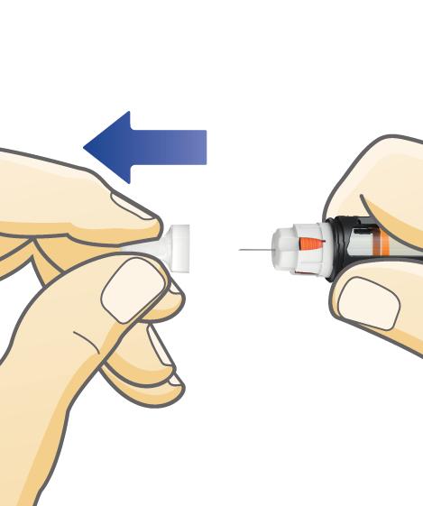 7 Ziehen Sie die innere Nadelkappe ab und werfen Sie sie weg. Es ist möglich, dass ein Insulintropfen an der Nadelspitze austritt.