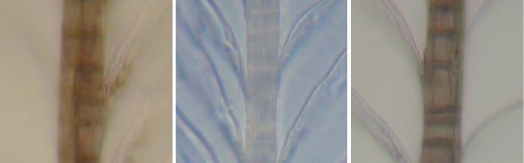 Dunen Die Dunenäste der Rückendeckfedern bestehen aus linear hintereinander angeordneten Zellen, die sichtbar Melanin eingelagert haben. Dabei sind die Zellwände stärker pigmentiert (Abb. 12).
