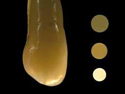 Vergleich unterschiedlicher SR Nexco-Komponenten zum natürlichen Zahn Bilder: Volker Brosch, Deutschland Bei Durchlicht kommen die lichtoptischen Eigenschaften voll zur Geltung: Die Opaleszenz und