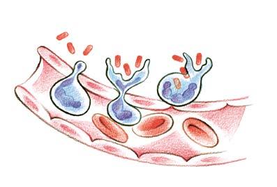 Neutrophile en Die Neutropenie Eine wichtige Gruppe von Blutzellen sind die neutrophilen en. Sie gehören zu den weissen Blutkörperchen, die helfen, Infektionen zu verhindern und zu bekämpfen.