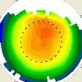 sleep & see freies Sehen Anpassung Orthokeratologie Beispiel eines Anpassverlaufs Kontrollen: Die Kontrolle des Sitzes und der Veränderungen der Hornhaut, muss anfangs in kurzen Intervallen