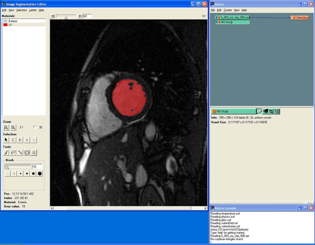 Abbildung 14: Im linken Fenster ist der Image Segmentation Editor zu sehen.