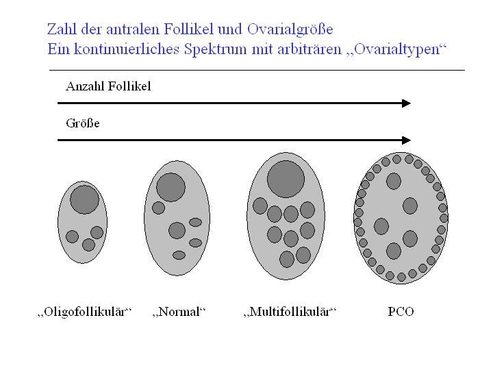 PCO-S: Rotterdam-Kriterien 2003 o Chronische Anovulation (Oligo-, Amenorrhoe) o