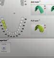 Überprüfen Sie die Scans auf fehlende Oberflächen oder falsche Ausrichtung. 3 2. Für unterschiedliche Ansichten und Funktionen klicken Sie auf die Symbole in der Werkzeugleiste. 3. Achten Sie darauf, dass die Gingivamasken und diagnostischen Wax-ups korrekt auf das Modell gesetzt erscheinen.