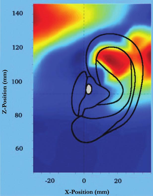 WINDGUARD : HÖRKOMFORT IN WINDIGEN SITUATIONEN Tammara Stender und Marcel Hielscher Kurzfassung Windgeräusche können für den Hörsystemträger eine frustrierende Hörerfahrung darstellen.