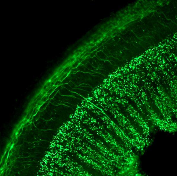 Der Indikator für den Einfluss der Spiralganglienzellen auf das Cortische Organ war die Degenerierung der Nervenfasern nach Eliminierung der Spiralganglienzellen.