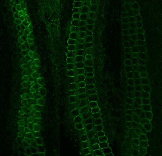 A B Apikal Medial Basal Apikal Medial Basal Abbildung 3: Prestin-Protein-Färbung im apikalen, medialen und basalen Fragment des Cortischen Organs von drei bis fünf Tage alten Ratten nach 48 Stunden