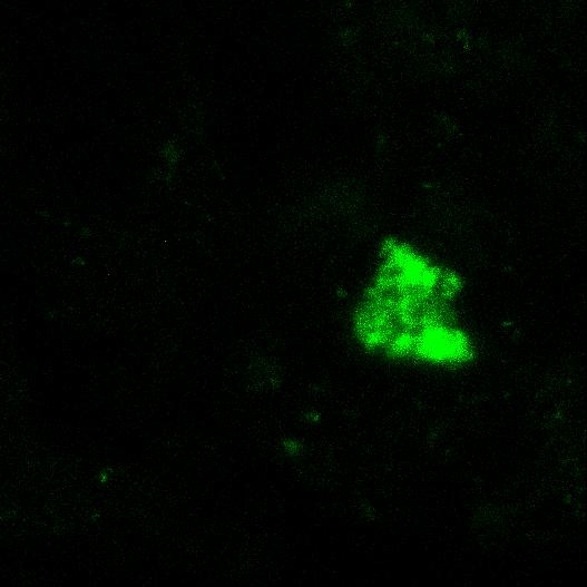 Rotfärbung unter Verwendung des DNA-interkalierenden Fluoreszenzfarbstoffes SYTO60] vom Biofilm eines magnetischen Aufwuchsträgers, welcher aus einem thermophilen Biogasreaktor nach 18 Wochen