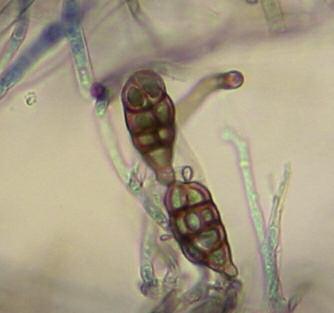 Die Sporen vieler Schimmelpilze zum Beispiel Aspergillus spp., Alternaria spp., Cladosporium spp. sowie Penicillium spp.