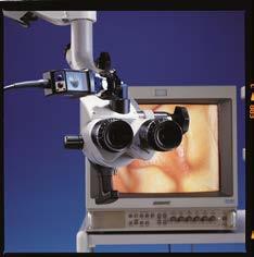 Vergrößerungswechsler Artikel: 102020 Endoport Videoausgang für Kamera mit Endoskopadapter für