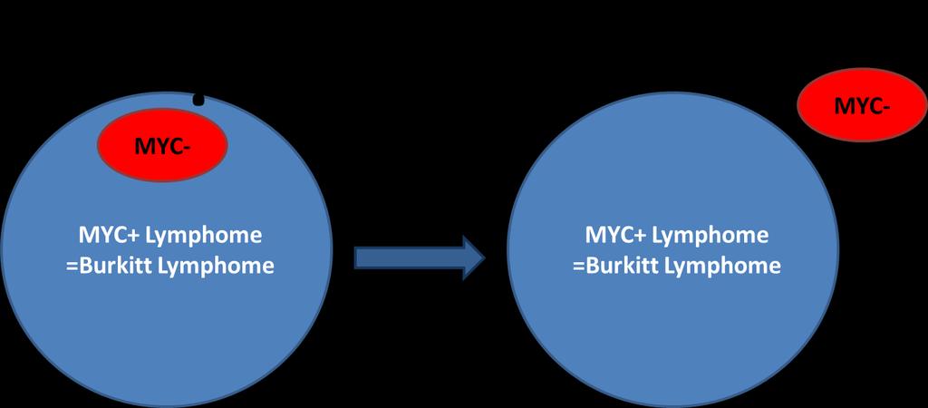 Identifizierung: MYC-negative Burkitt