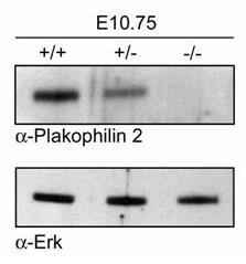 Western-Blot: Workflow Übertragung von Proteinen auf eine