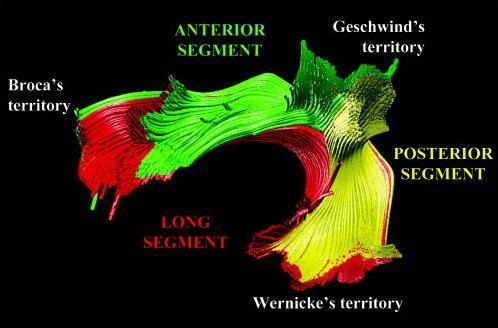 14 Verbindung von Broca- und Wernicke-Zentrum über den Fasciculus arcuatus auch noch eine indirekte Route in perisylvischen Sprachgebieten beinhaltet, die parallel und lateral zu der klassischen