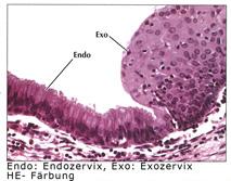 Die Grenzlinie zwischen der Ektocervix und der Endocervix muss nicht genau mit dem äußeren Muttermund übereinstimmen.