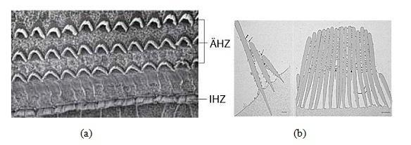 2.3.2 Die Haarzellen Auf der Basilarmembran liegen die Haarzellen, eine Reihe innere Haarzellen und drei Reihen äußere Haarzellen (Abb. 7 (a)).