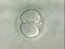 embryonic stem